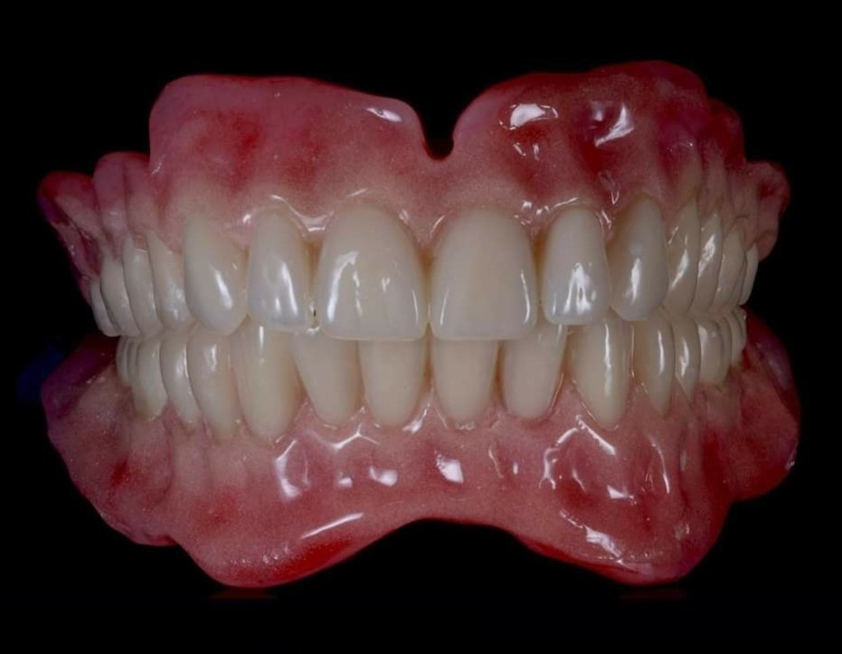 Private Dentures @ Dundee dental lab